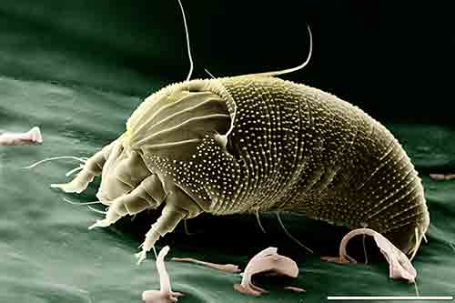 acaros alergia hogar